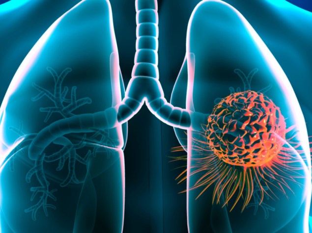 ologramma di polmoni inseriti all'interno della rappresentazione 3D di un corpo