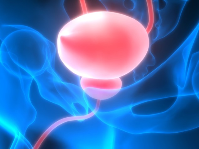 vescica rappresentata in 3D