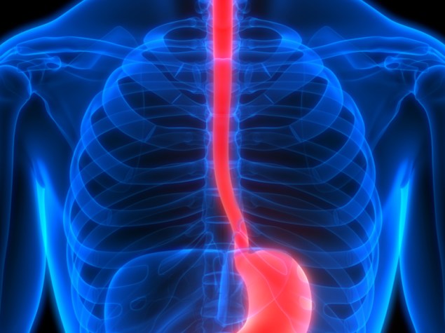 corpo umano in 3D con tumore all'esofago