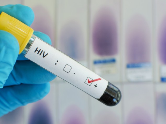 provetta con hiv positivo