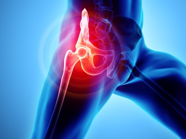 Immagine 3d di un'anca