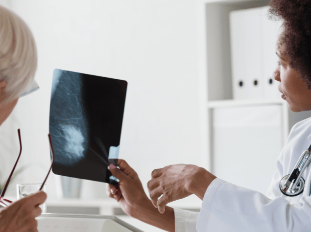 donna anziana che effettua una mammografia