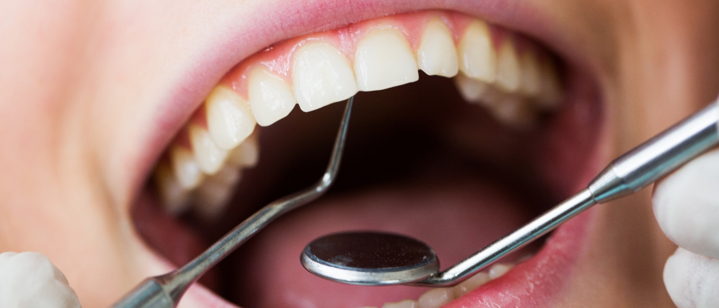 Ricostruzione dentale: scansioni CBCT e corone provvisorie in resina  acrilica - MSD