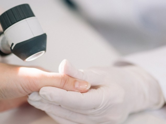 medico che osserva una lente la pelle sulla mano di un paziente