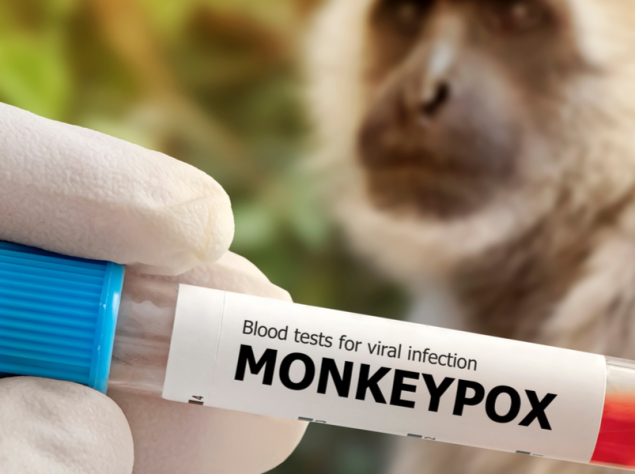 mano con guanto tiene tra le dita provetta con scritta monkeypox