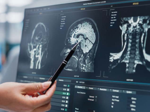 Medico analizza lastra cranica