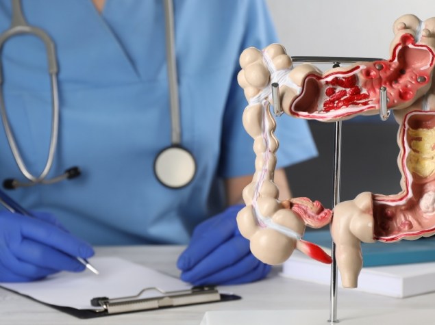 medico che prende appunti su un foglio a fianco ad un modello plastico di intestino
