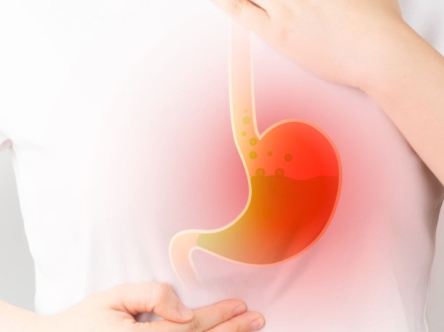 illustrazione di uno stomaco infiammato