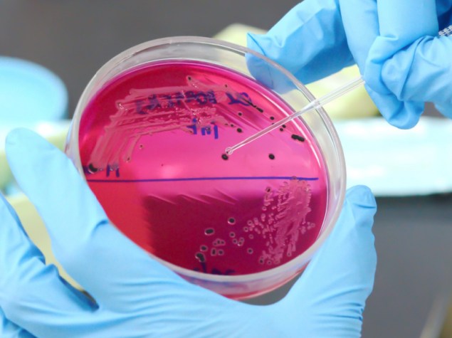 Primo piano della crescita della colonia di salmonella touch loop su piastra di supporto selettivo nel laboratorio di microbiologia