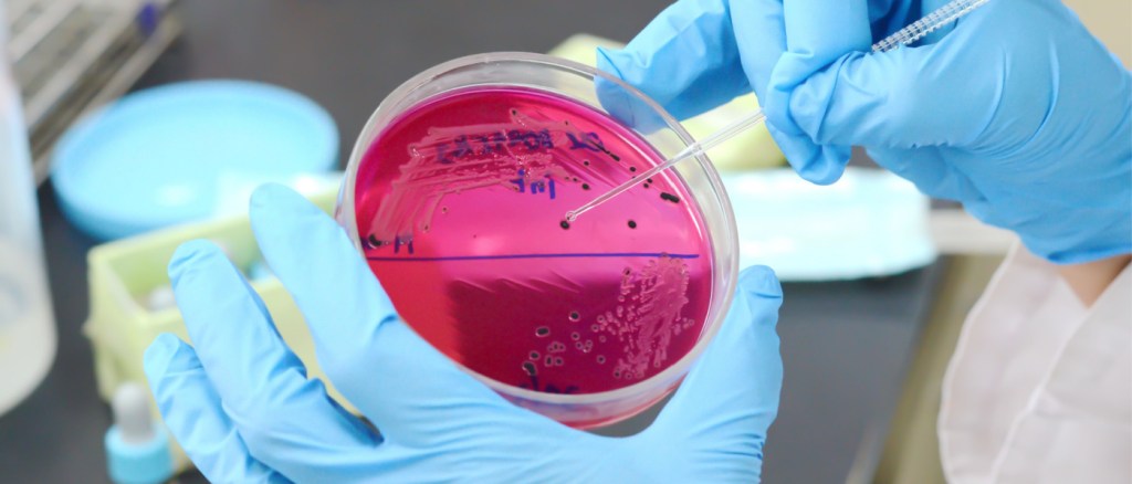 Primo piano della crescita della colonia di salmonella touch loop su piastra di supporto selettivo nel laboratorio di microbiologia