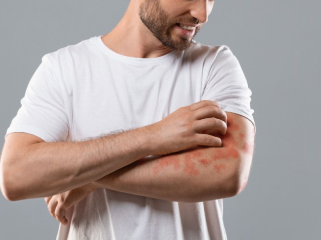 Concetto di dermatite, eczema, allergia, psoriasi. Uomo di mezza età infastidito con maglietta bianca che si gratta il prurito sul braccio, sfondo grigio di studio. Uomo barbuto che si gratta il prurito sul gomito, spazio copia