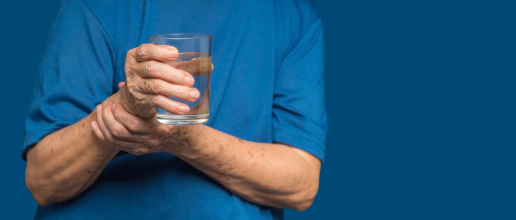 Primo piano delle mani di una donna anziana che cerca di tenere un bicchiere d'acqua. Le cause del tremore delle mani includono il morbo di Parkinson, l'ictus o le lesioni cerebrali. Disturbo neurologico della salute mentale