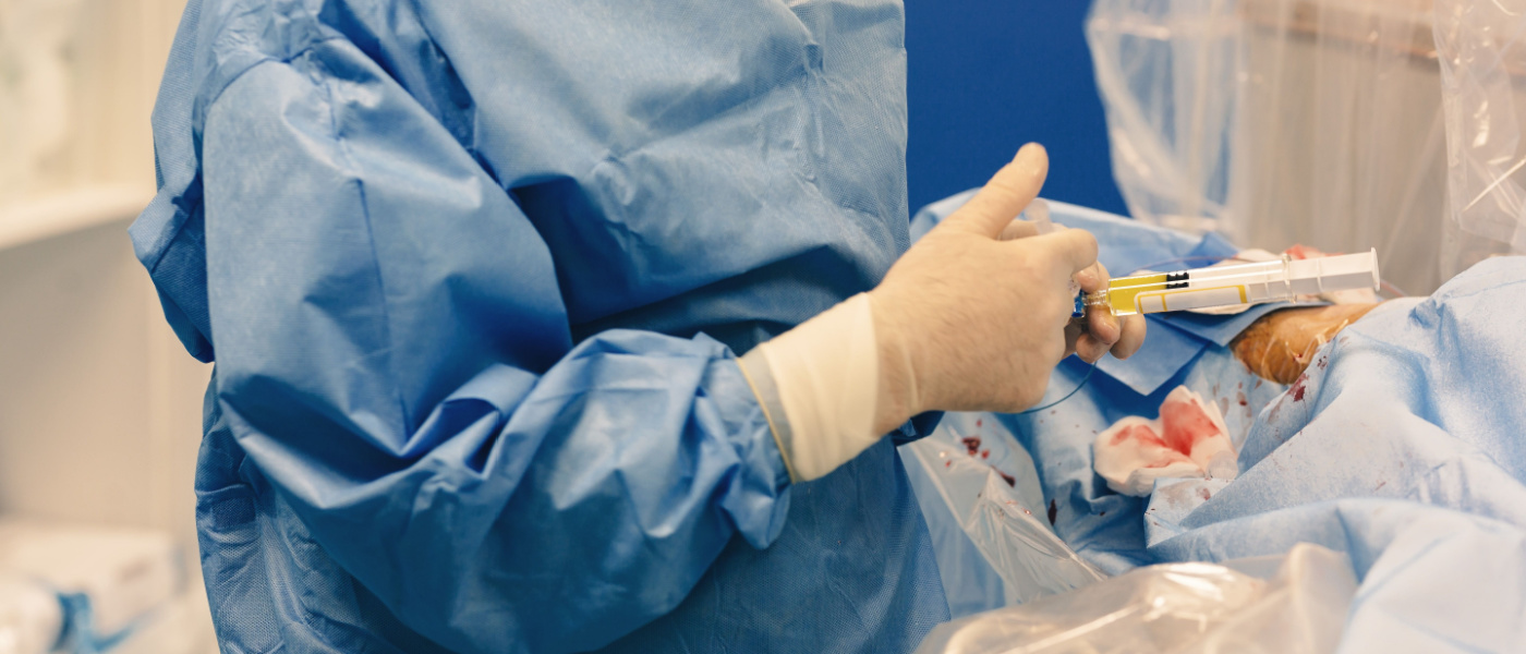 La procedura di embolizzazione eseguita da un radiologo interventista blocca l'afflusso di sangue ai fibromi dell'utero, chiamata embolizzazione dell'arteria uterina, utilizzando raggi X in tempo reale su schermo con fluoroscopia.