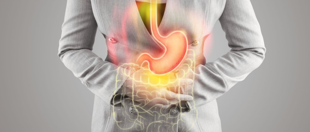L'illustrazione dello stomaco e dell'intestino crasso si trova sul corpo della donna su uno sfondo grigio. Reflusso acido.