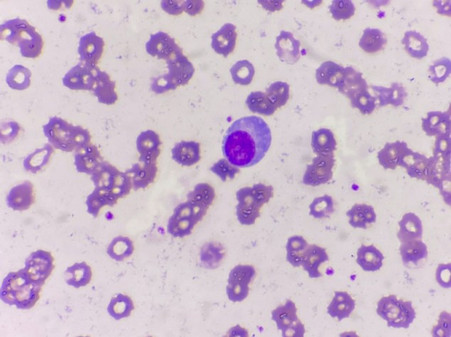 Globuli bianchi al microscopio