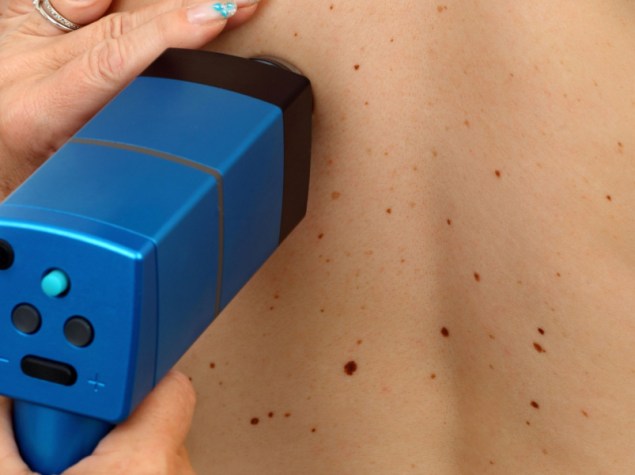 medico che controlla la schiena nuda di un paziente con nei
