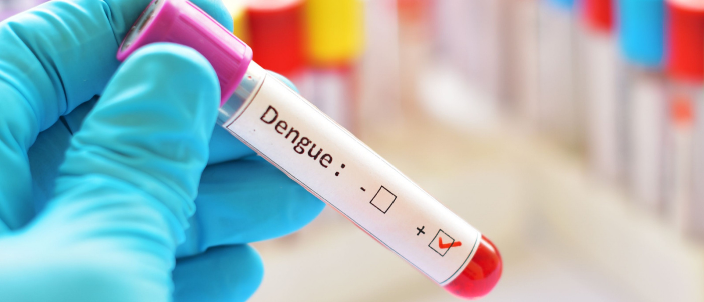 operatore tiene in mano una provetta di sangue positivo alla dengue