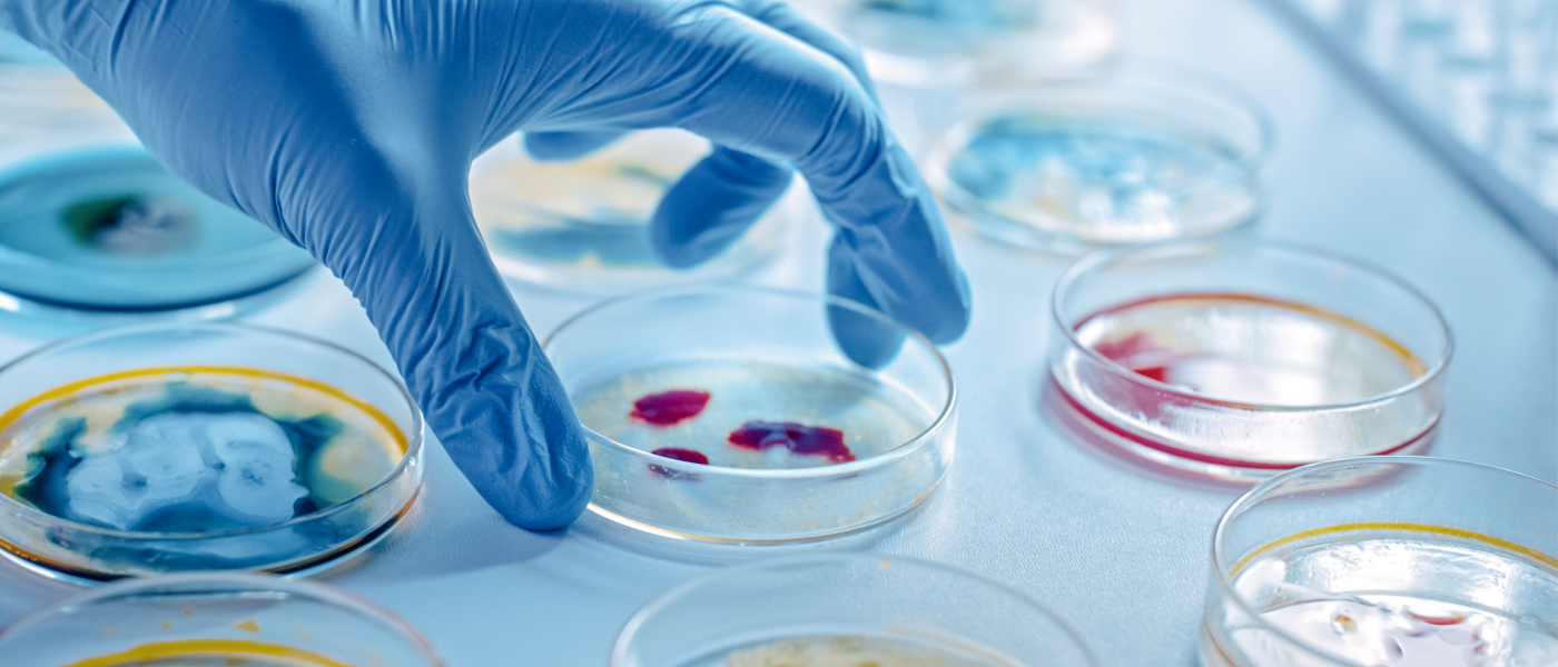 campione di sangue in laboratorio