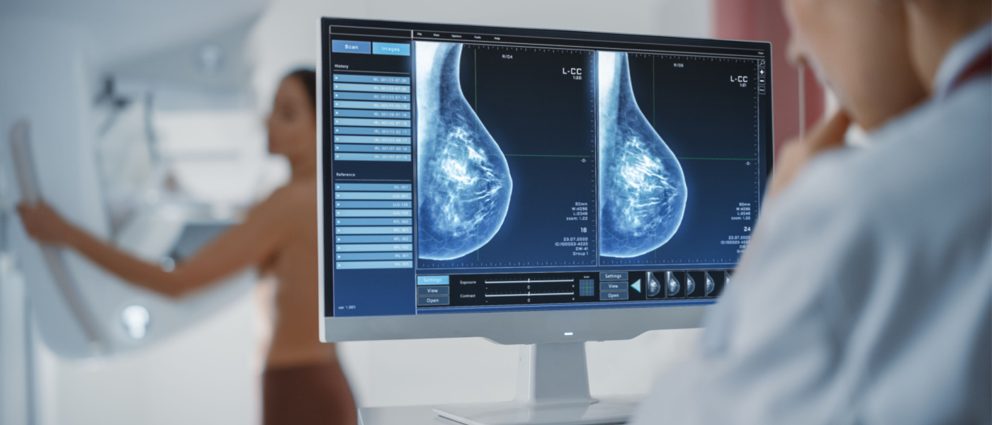 Mammografia