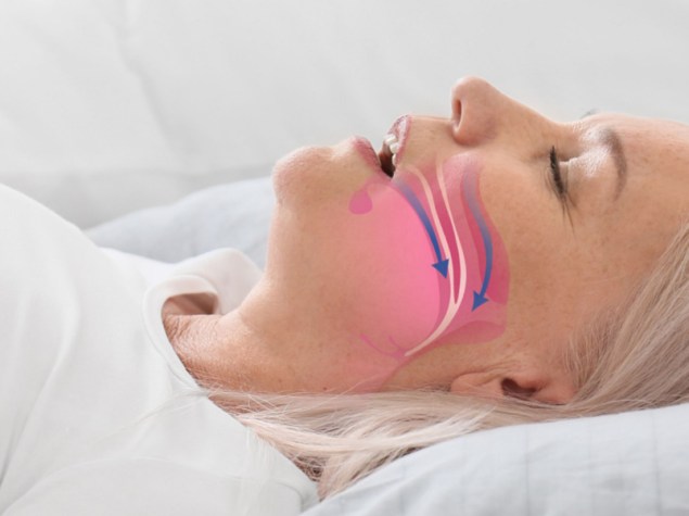 donna che dorme con illustrazione sull'aria che entra nella bocca