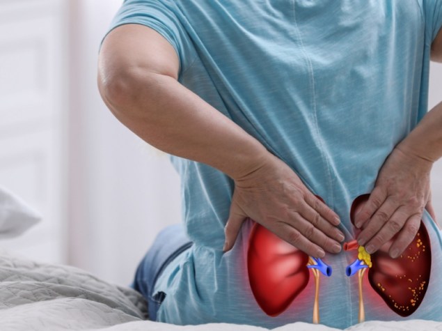 Donna con infiammazione ai reni