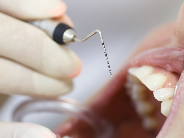 Dentista che visita paziente