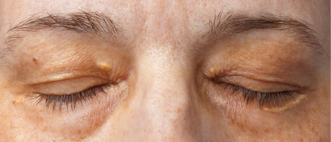 donna con occhi chiusi