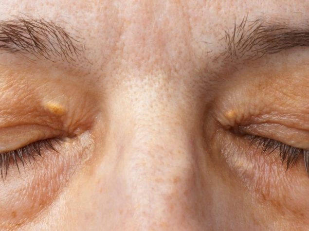 donna con occhi chiusi