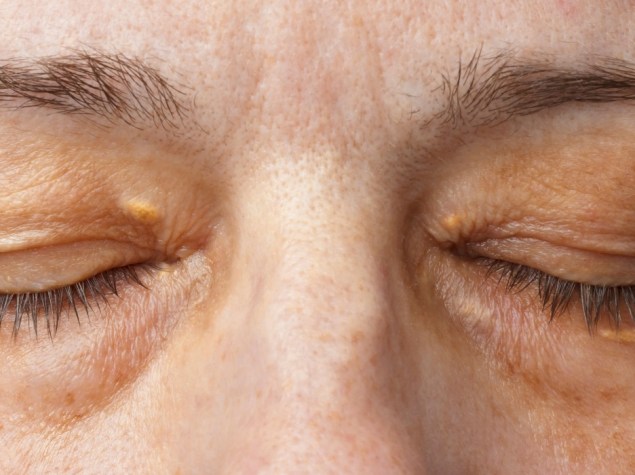 donna con occhi chiusi