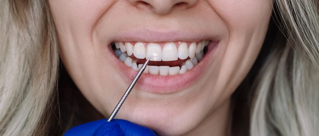 Donna che mostra i denti ad un dentista