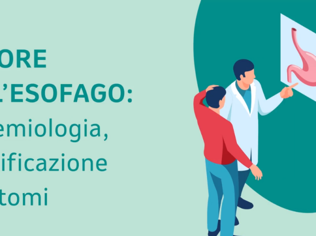 Tumore dell'esofago infografica
