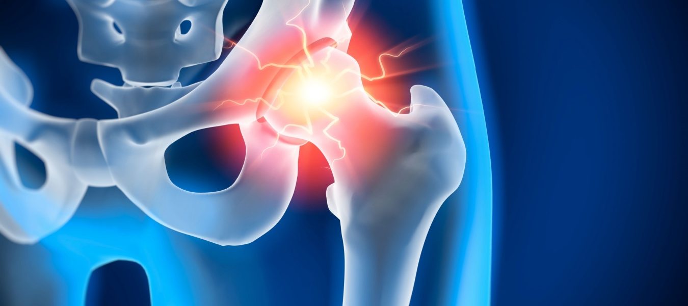 Rappresentazione anca