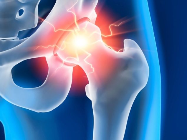 Rappresentazione anca