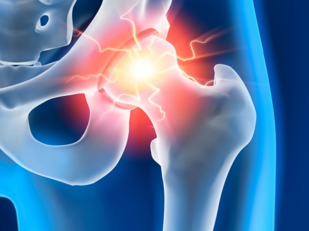 Rappresentazione anca