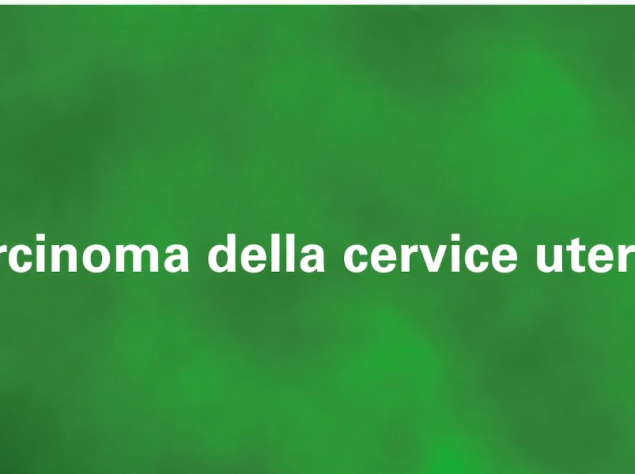 scritta bianca "carcinoma della cervice uterina" su sfondo verde