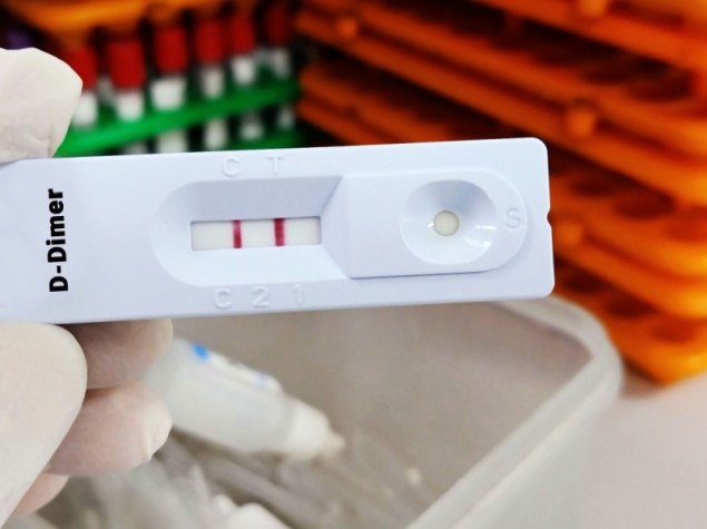 test D-dimer