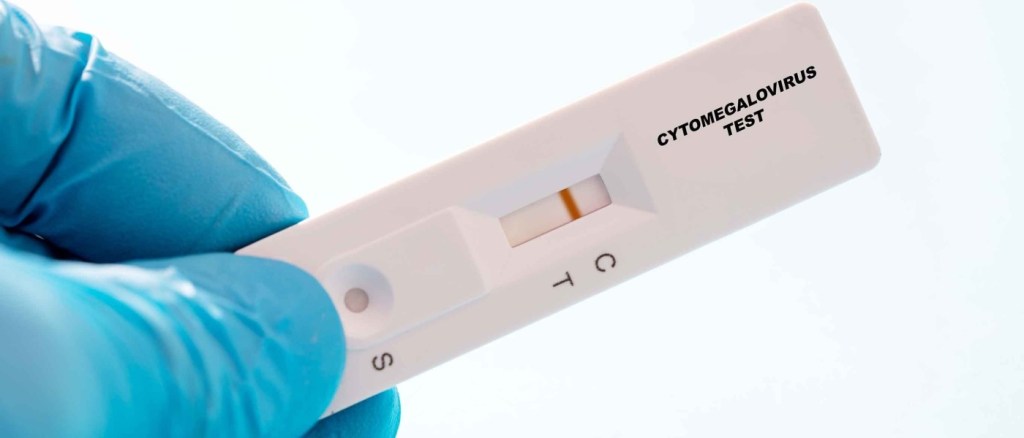 TEST CMV
