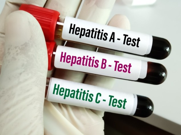 test epatite
