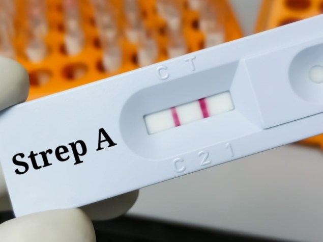 Streptococco test