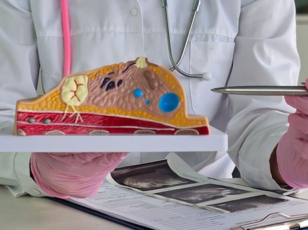 Un medico che mostra un tumore o un cancro al seno su un modello anatomico del seno per educare le donne sulla prevenzione e il trattamento delle malattie del seno