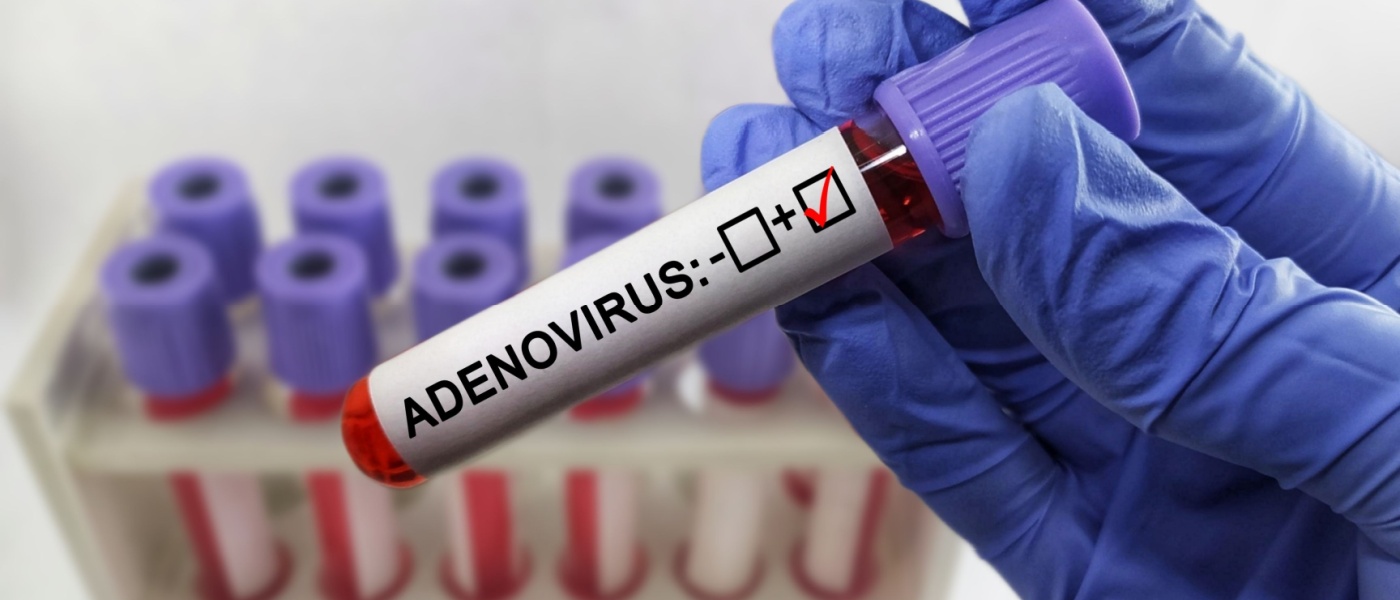 provetta di adenovirus
