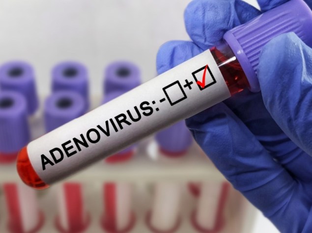 provetta di adenovirus