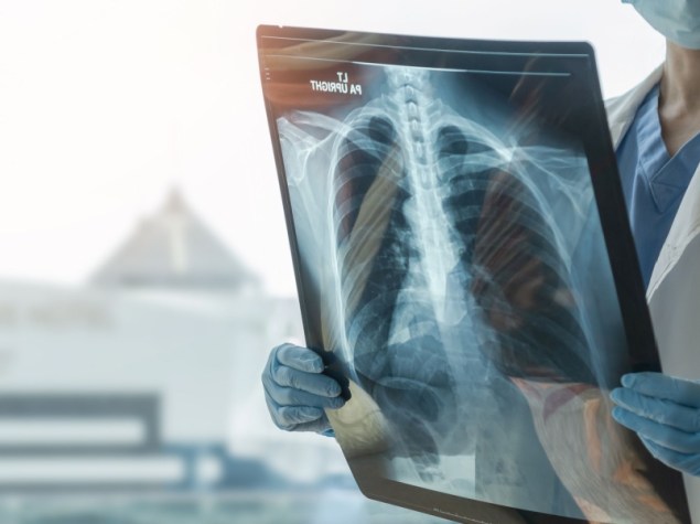 dottoressa che tiene in mano ecografia