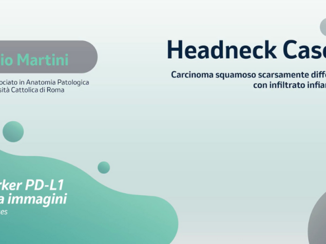 HEADNECK case 51 professore Martini