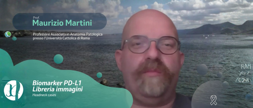 copertina professore Martini Biomarker PD-L1