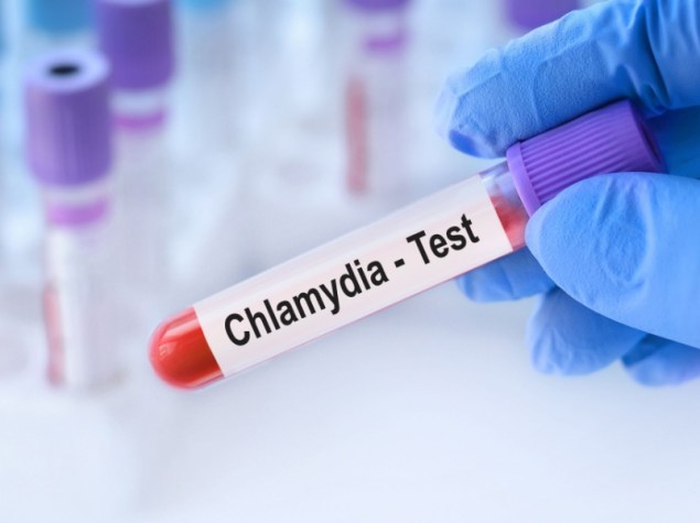 Medico che tiene in mano un campione di sangue di test di Chlamydia