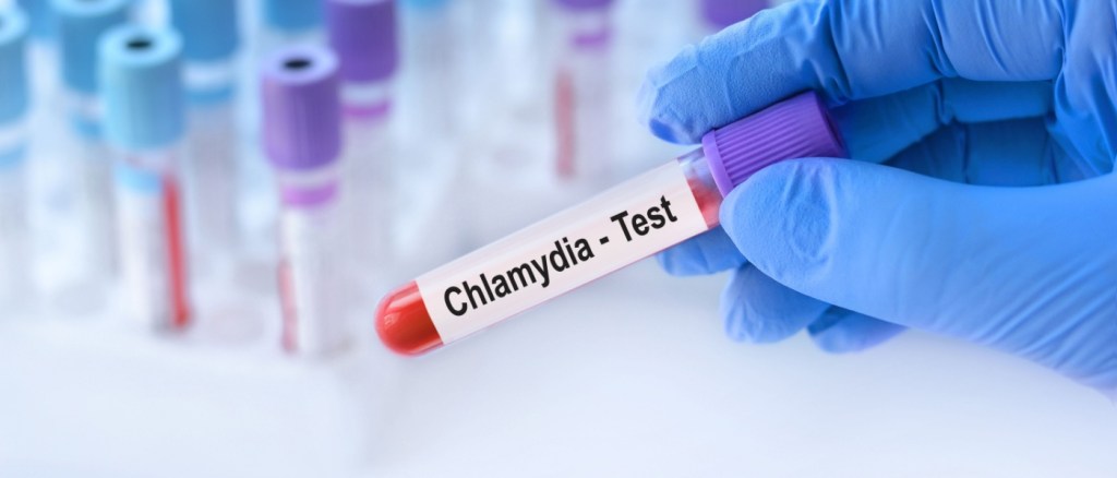 Medico che tiene in mano un campione di sangue di test di Chlamydia