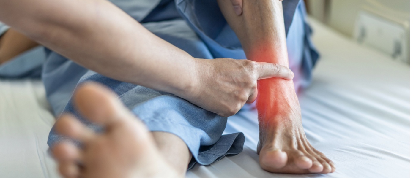 piede e caviglia infiammata