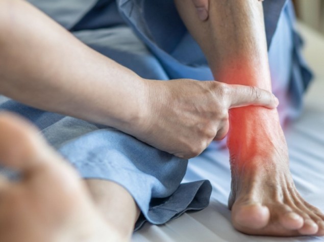 piede e caviglia infiammata