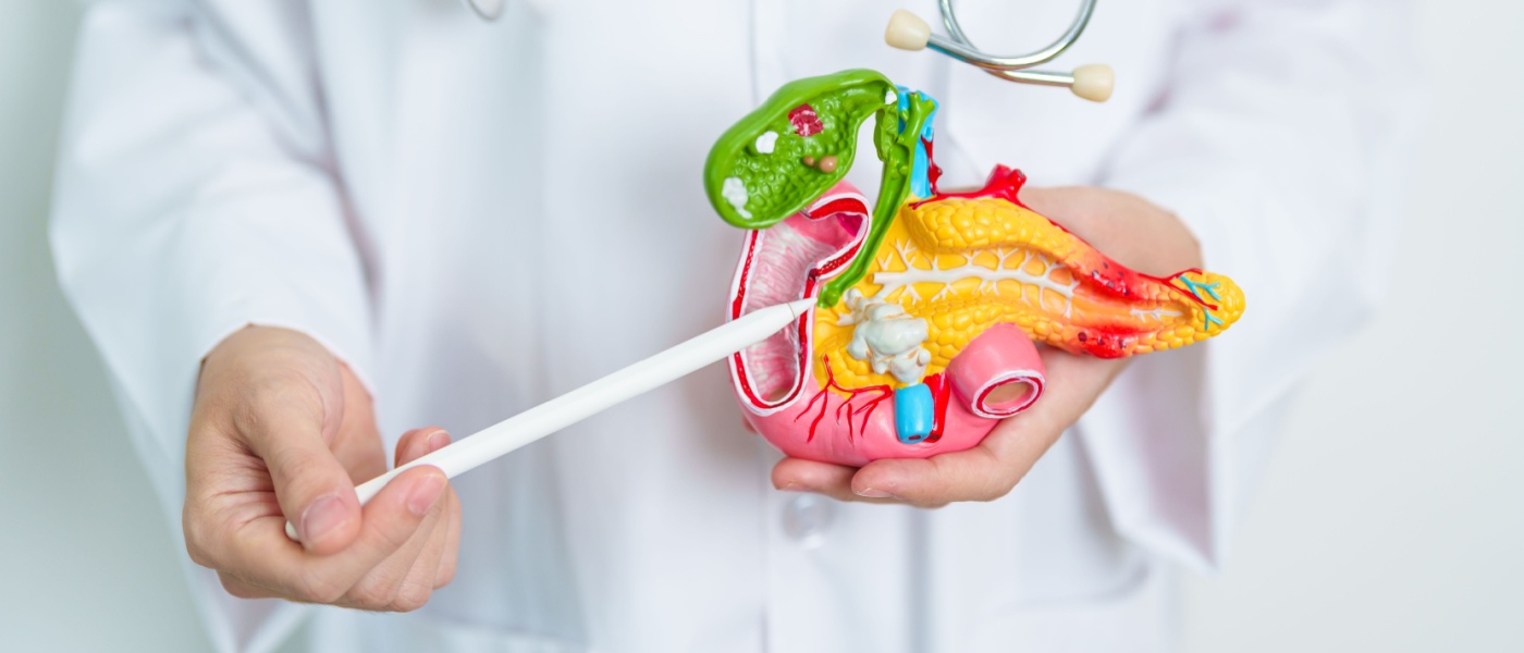 Colangiocarcinoma-pancreas